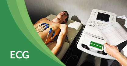 ECG